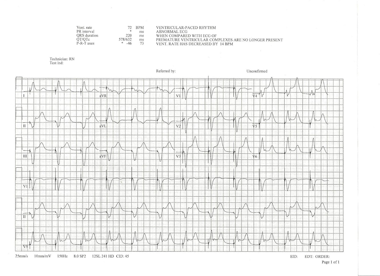 Dr. Smith's ECG Blog Hours out of the OR for valve replacement surgery