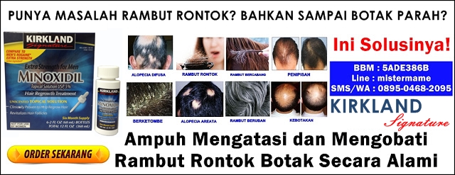 KIRKLAND SIGNATURE Minoxidil Obat Penumbuh Rambut Terbaik