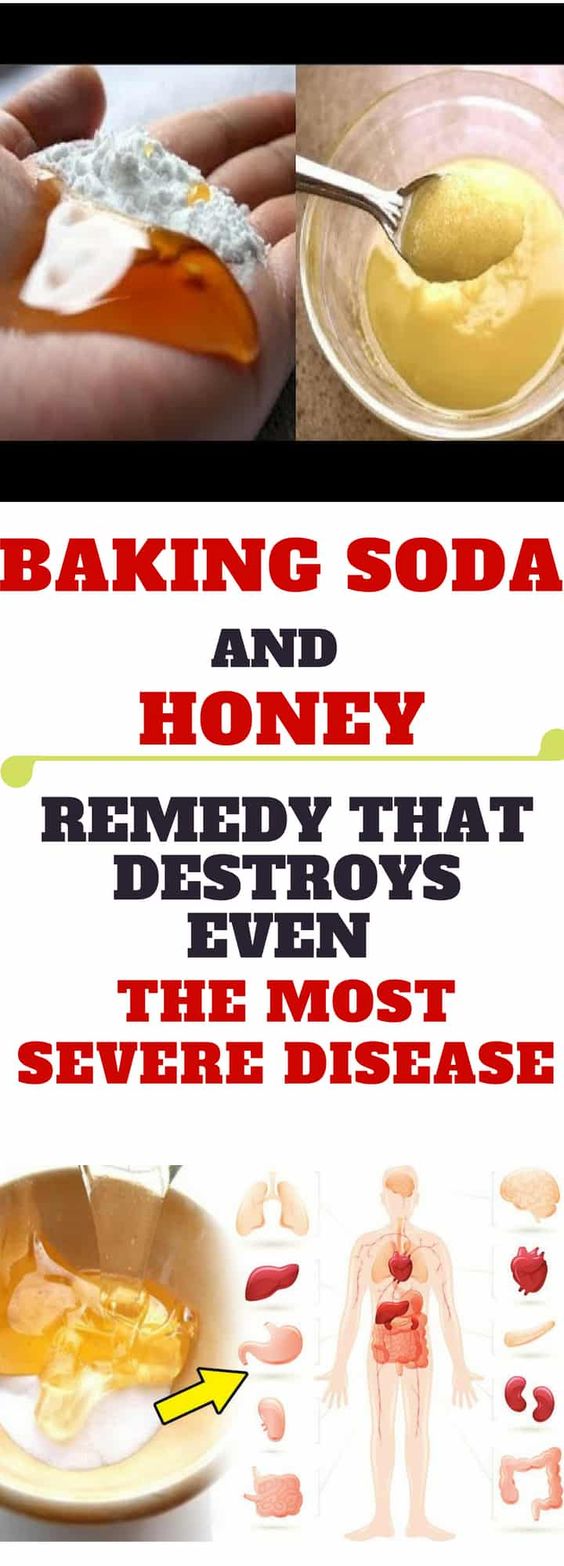 BAKING SODA AND HONEY REMEDY THAT DESTROYS EVEN THE MOST SEVERE