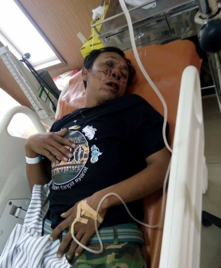 Foto foto Korban Kecelakaan Salah Seorang Pengendara Vespa 