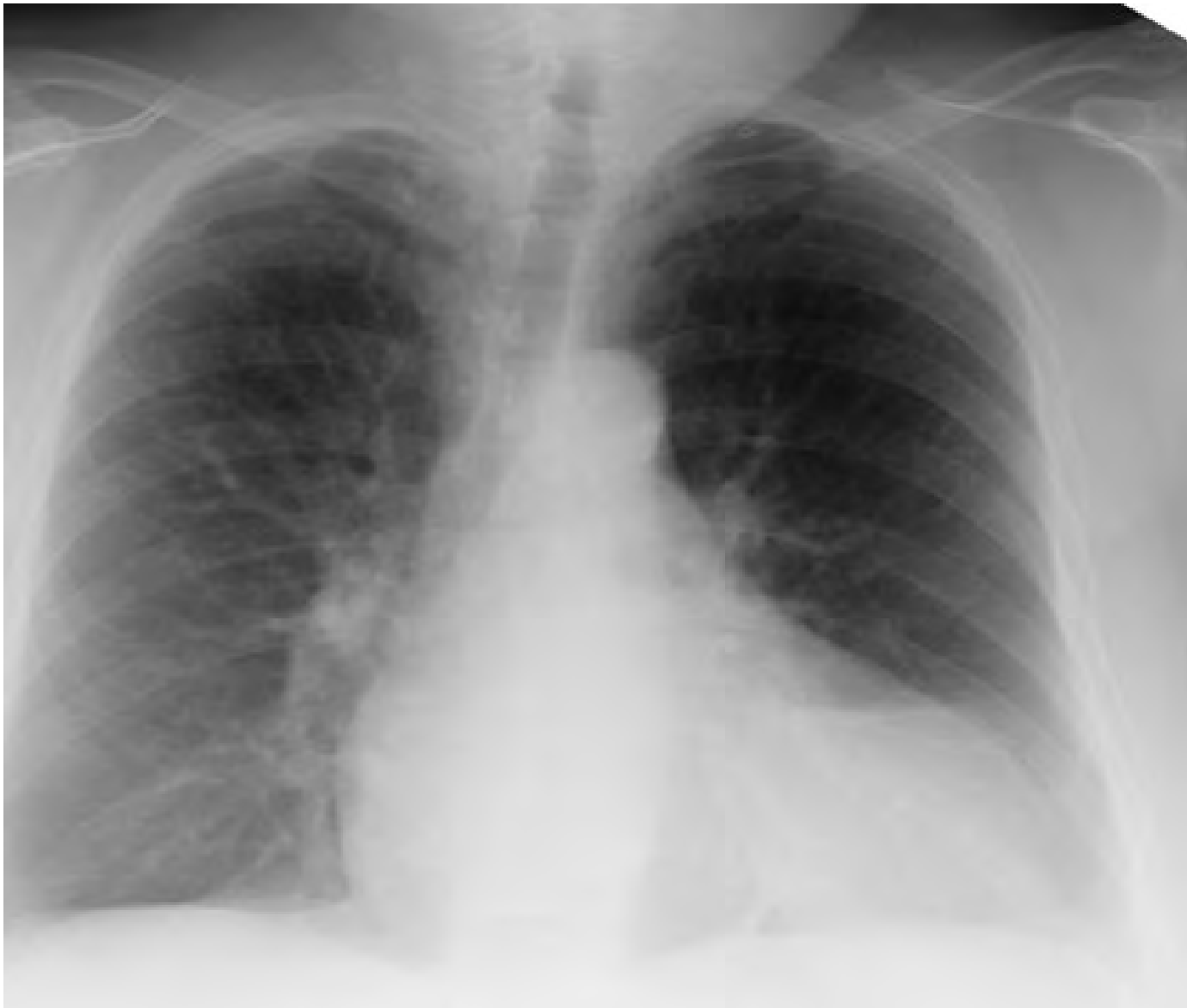 Doctors Network Chest radiograph of different conditions