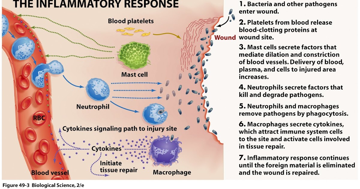 Anatomy & Physiology II: The Inflammatory Response Biology Diagrams