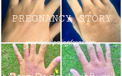 Pregnancy Story : Gatal-gatal pada kulit bumil 