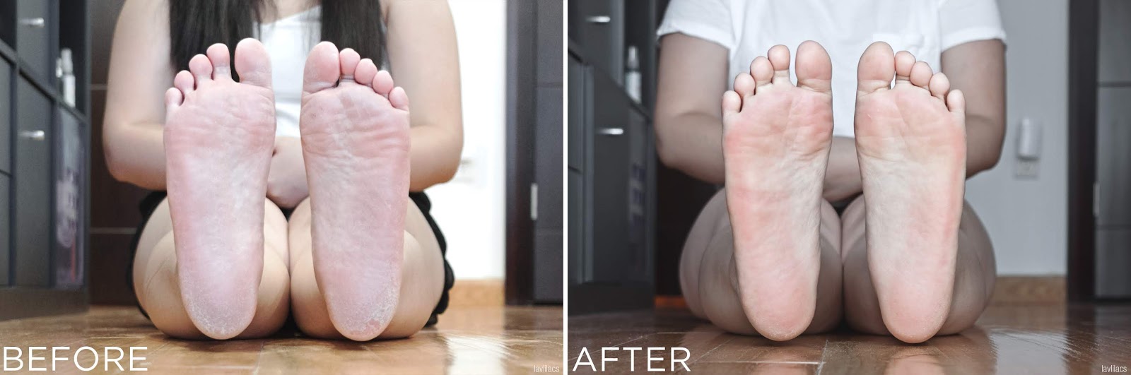 lavlilacs the SAEM Dear My Foot Power Peeling - Before and After