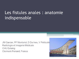 Les fistules anales : anatomie indispensable .pdf