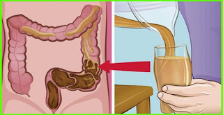 This Drink Completely Cleans Your Colon And Gets Rid Of Bloating