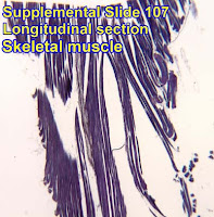 HISTOLOGY PICTURES: Muscle