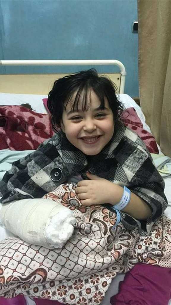 صورة قرد يلتهم أيدى طفلة صورة قرد يلتهم أيدى طفلة