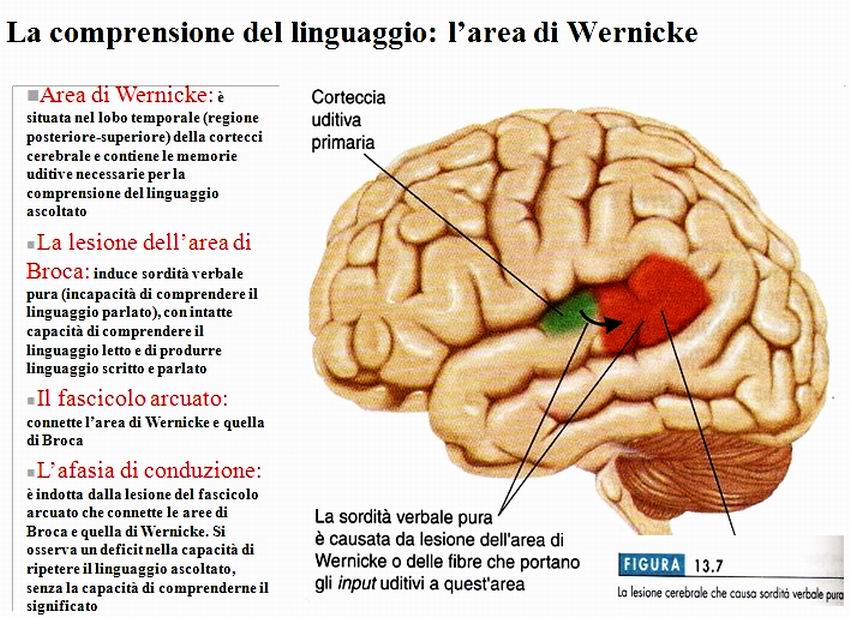 Area Di Broca E Di Wernicke Afasia di wernicke