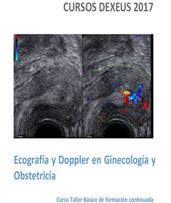 Todo Ecografía Médica Curso teórico práctico de Ecografía y Doppler en