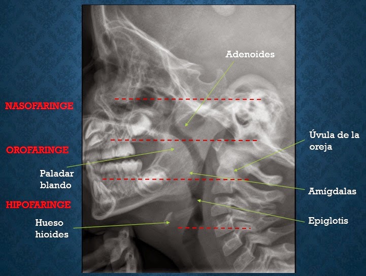 ESPE 202 - 2014: Anatomía y patología de cuello