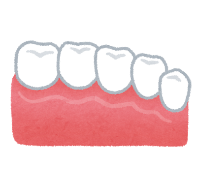 セラミックの歯のイラスト（歯の治療）