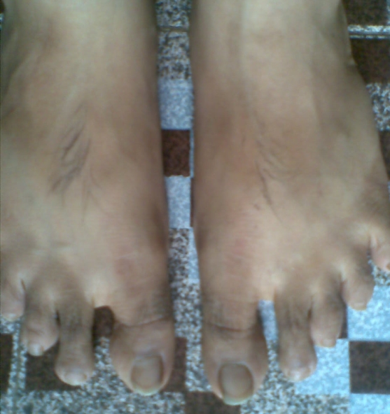 Waxing's Best For Toe Hair Beauty and Personal Grooming