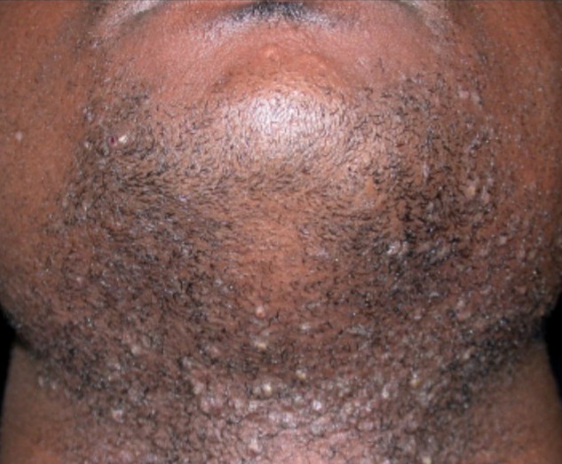 10 Ways To Step Up Your Beard Game