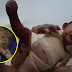 Bantulah adik Aqif yang menderita penyakit Epidermolysis Bullosa