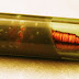 Doctor Extracts RFID Chip From Sex Trafficking Victim Everyone Called Crazy