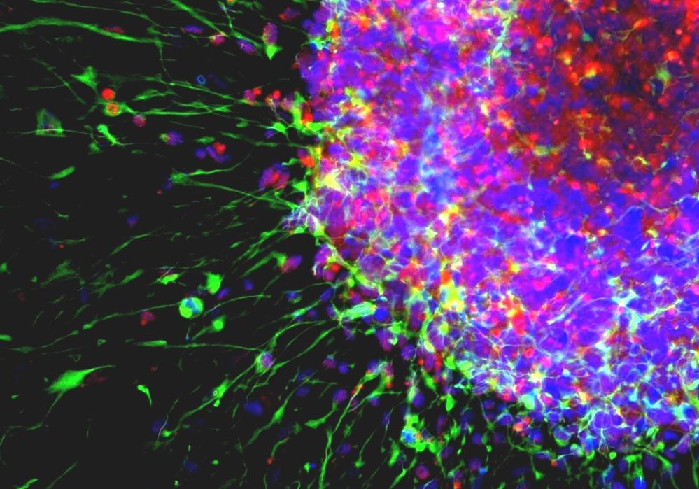 progenitor cells definition progenitor cells definition