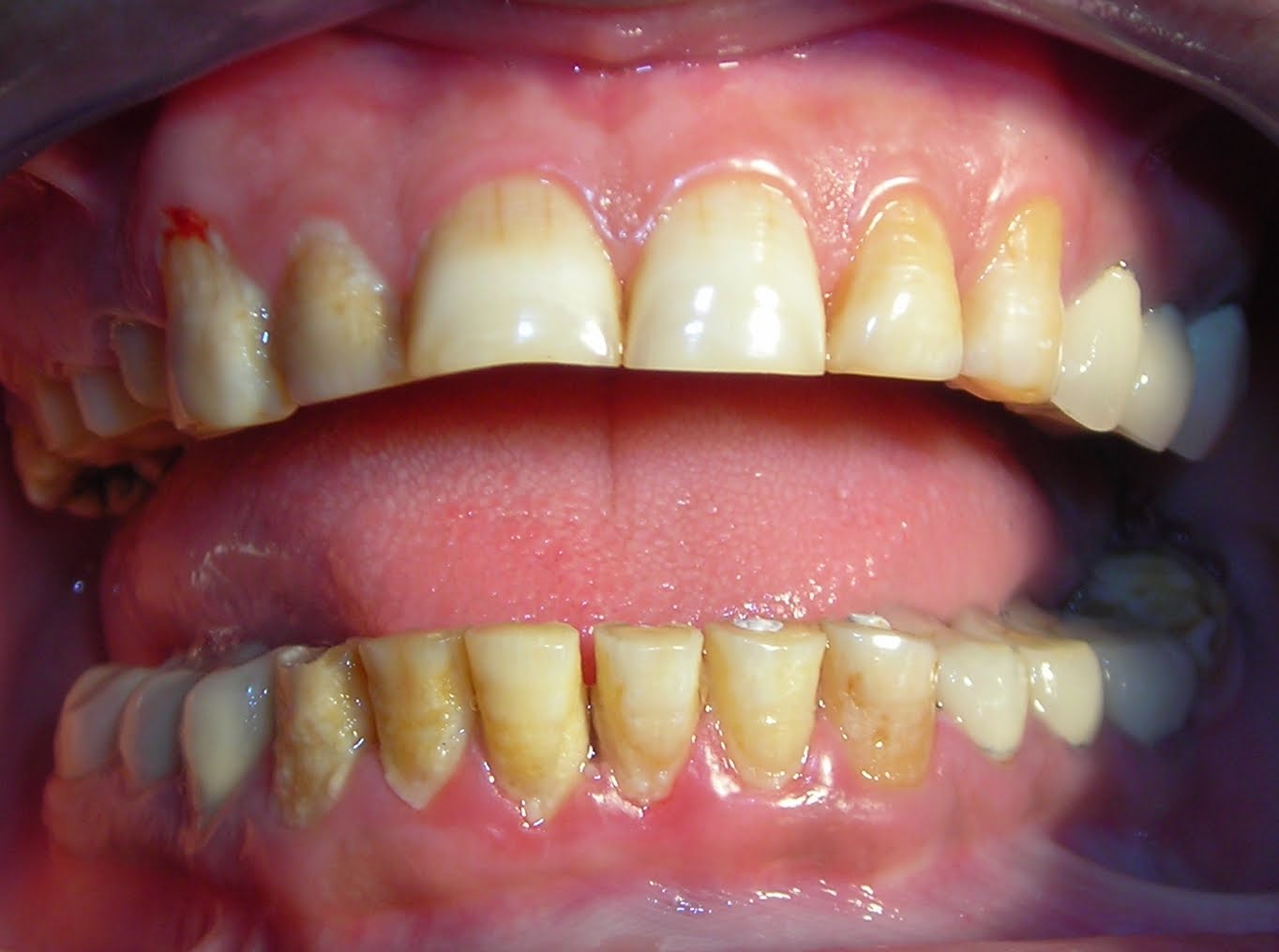 Restorative Dentistry & Endodontics March 2011