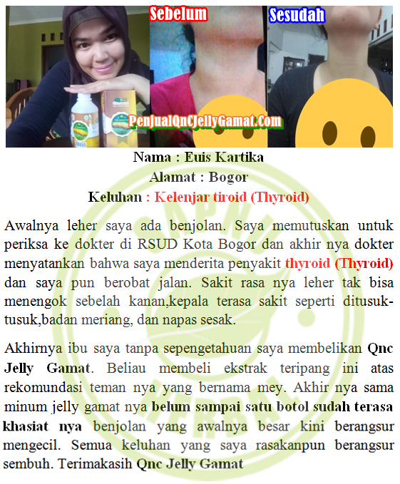 Cara Menyembuhkan Penyakit Hipertiroid Secara Alami Tanpa Operasi ~ TESTIMONI QNC JELLY GAMAT Cara Menyembuhkan Penyakit Hipertiroid Secara Alami Tanpa Operasi ~ TESTIMONI QNC JELLY GAMAT