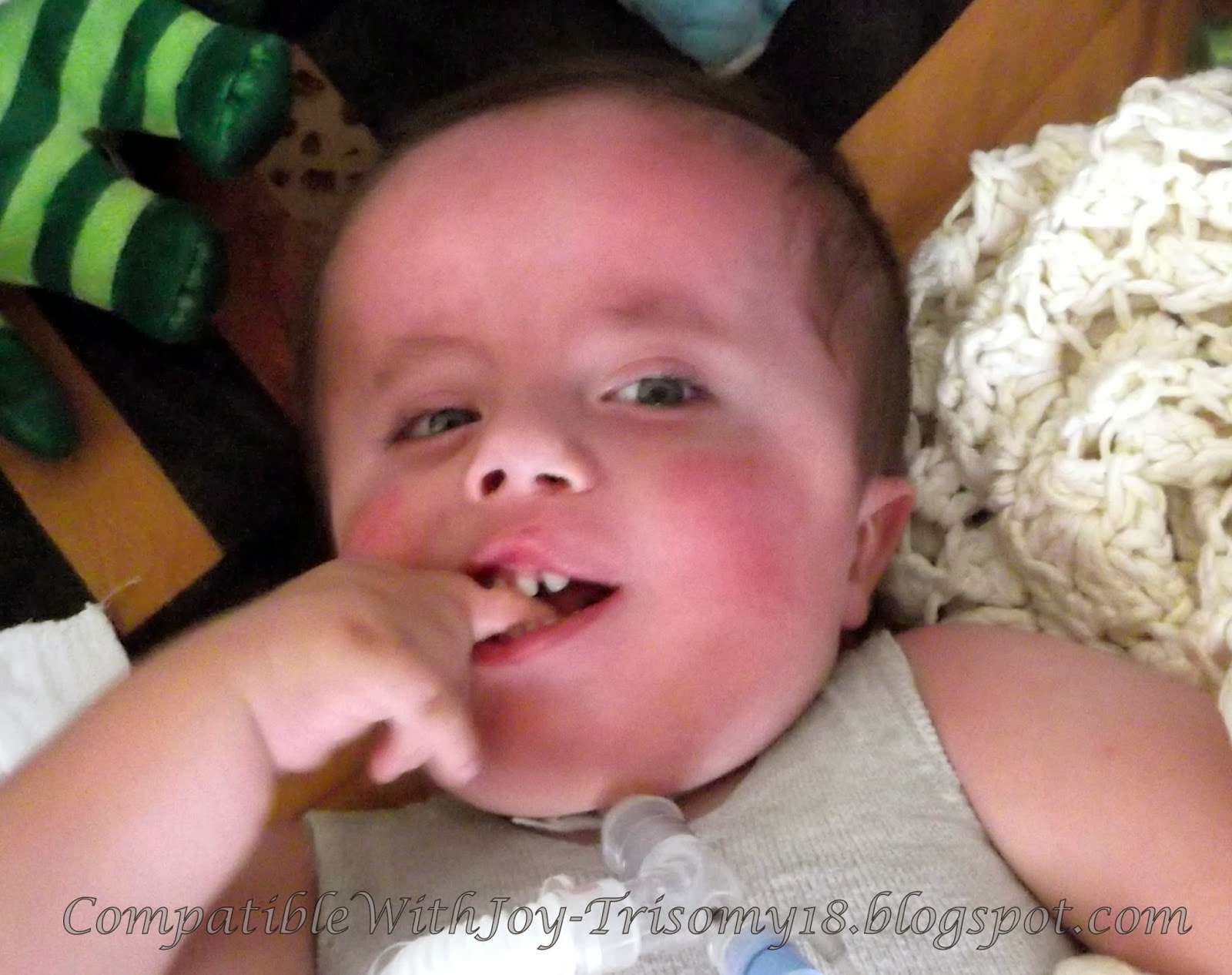 Compatible With JoyTrisomy18 Everything in the Mouth