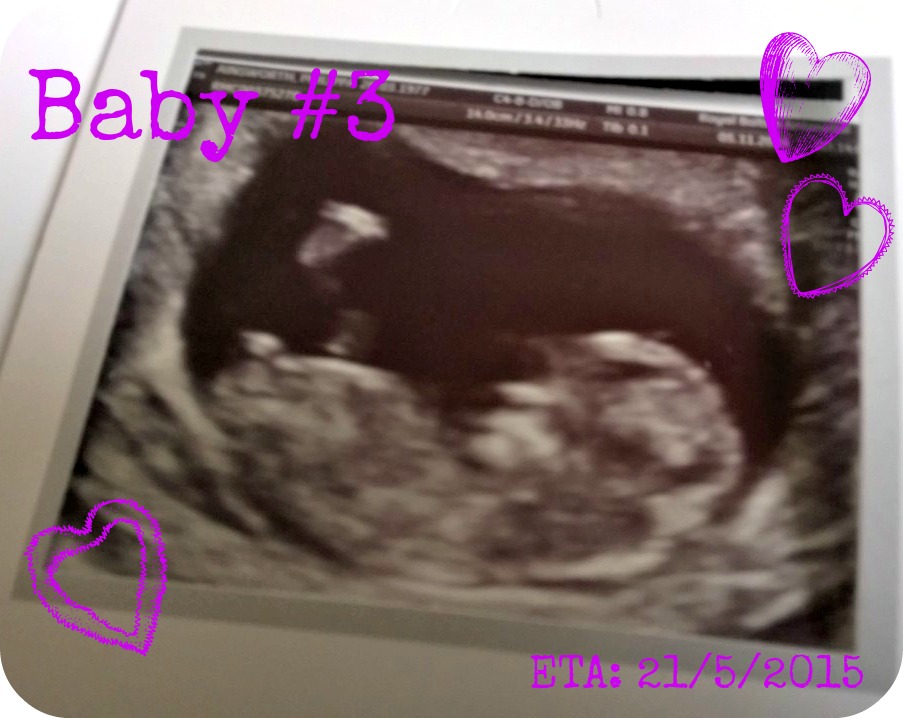 Baby #3 Scan Photo