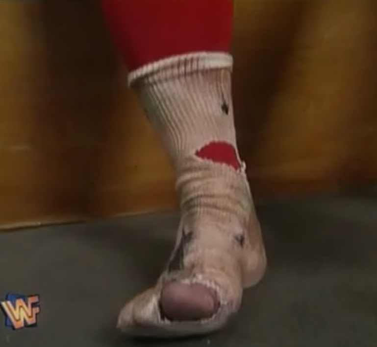 WWF / WWE - King of the Ring 1995 - Jerry Lawler made his foot as nasty as possible ready for his 'Kiss My Foot' match against Bret Hart