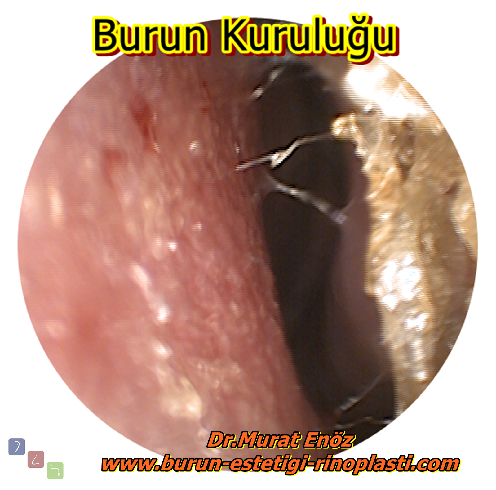 Burun Etleri İle İlgili Farklı Bilgiler