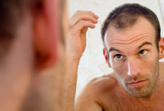 Waspadalah, Pria Botak Berisiko Lebih Tinggi Menderita Kanker Prostat [ www.BlogApaAja.com ]