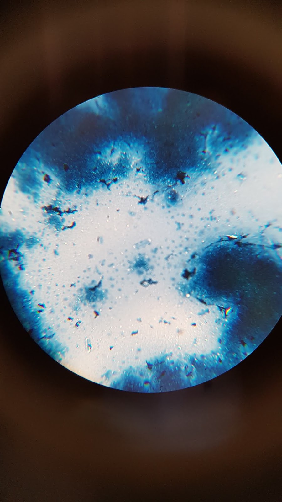 Práctica 7. Observación al microscopio de un yogur de fresa con azul de metileno Práctica 7. Observación al microscopio de un yogur de fresa con azul de metileno