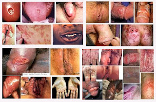 Obat Raja Singa Ampuh Obat Raja Singa Ampuh