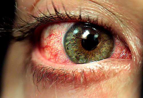 pourquoi la weed donne les yeux rouges