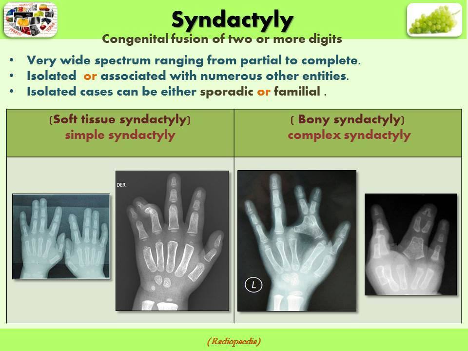 Easy Radiology Congenital Bone diseases & malformation and normal