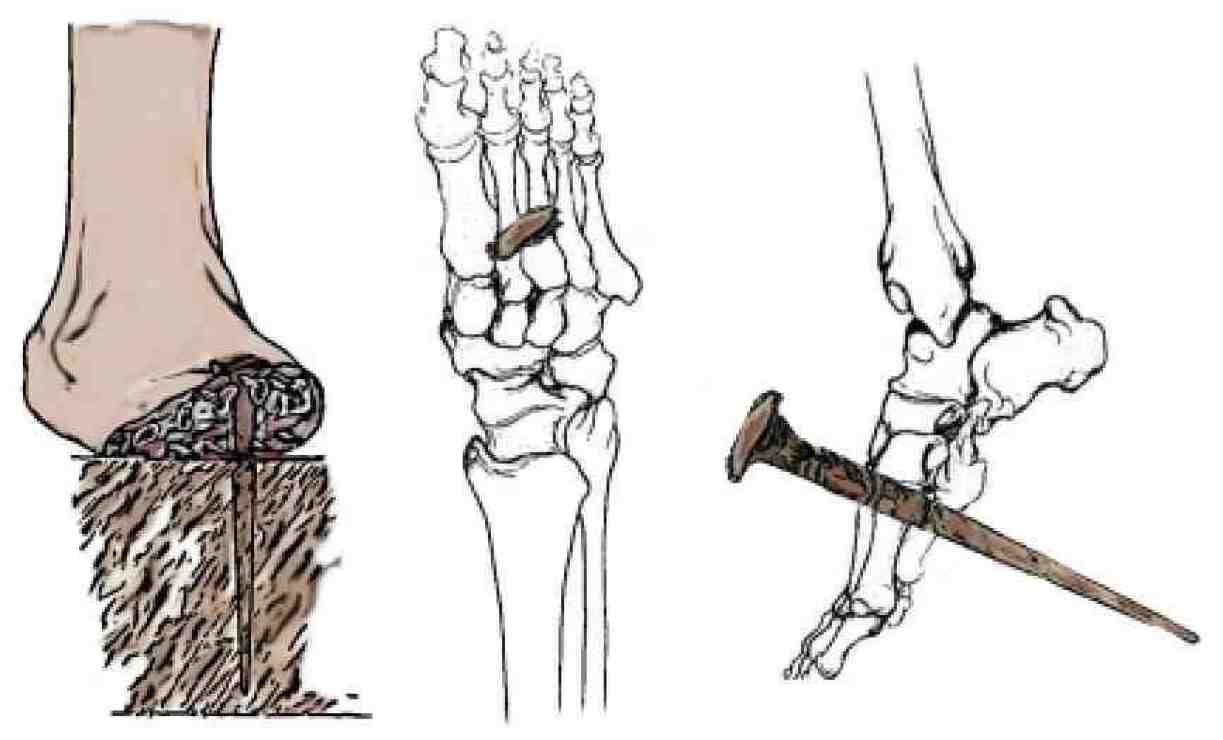 imágeneshistóricas.blogspot.es Crucificados