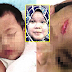 Dahi bayi terkoyak dicampak pengasuh taska