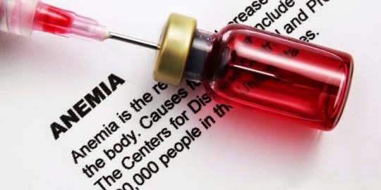 Tips Mengatasi Anemia (Kekurangan Zat Besi) Semasa Hamil Sebelum Dimarahi Nurse