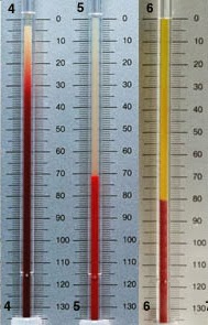 LED (laju endap darah ) | lorensatresna