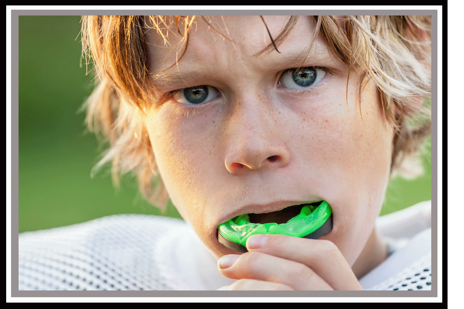 Dental Associates of Farmington, CT Athletic Mouthguards