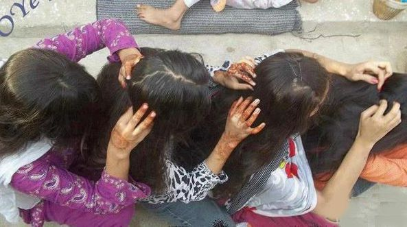 Cara Ampuh Hilangkan Gangguan Kutu Rambut Secara Mudah dan Alami