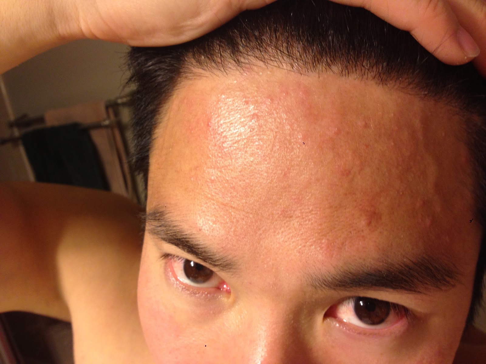 MEDICAL MIRACLES : 17 Signs You’re Eating Too Much Sugar