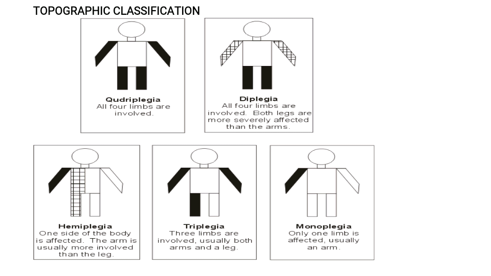 cerebral palsy definition cerebral palsy types PHYSIO STUDY