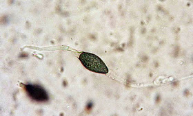 Podospora appendiculata showing caudate