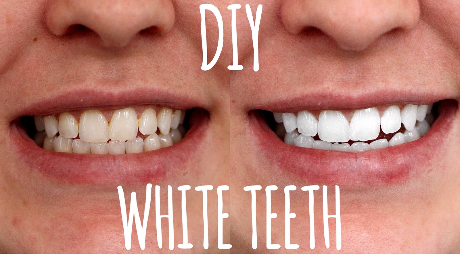 How To Make Yellow Teeth White Again Yellow Choices