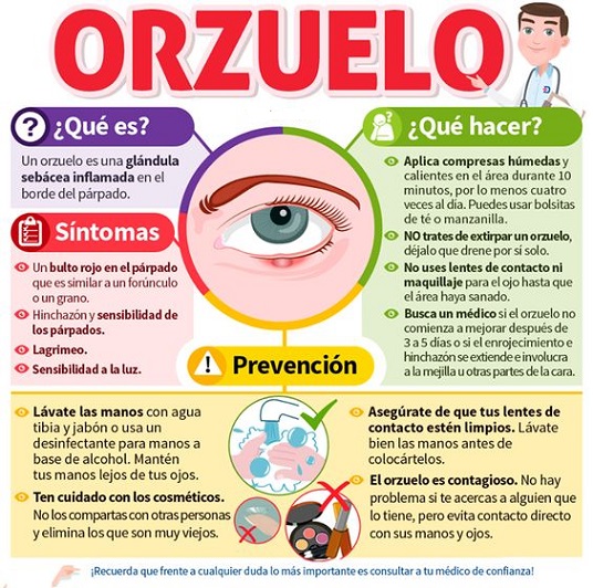 Aprende A Diferenciar De Una Manera Fácil Entre Chalazión Y Orzuelo