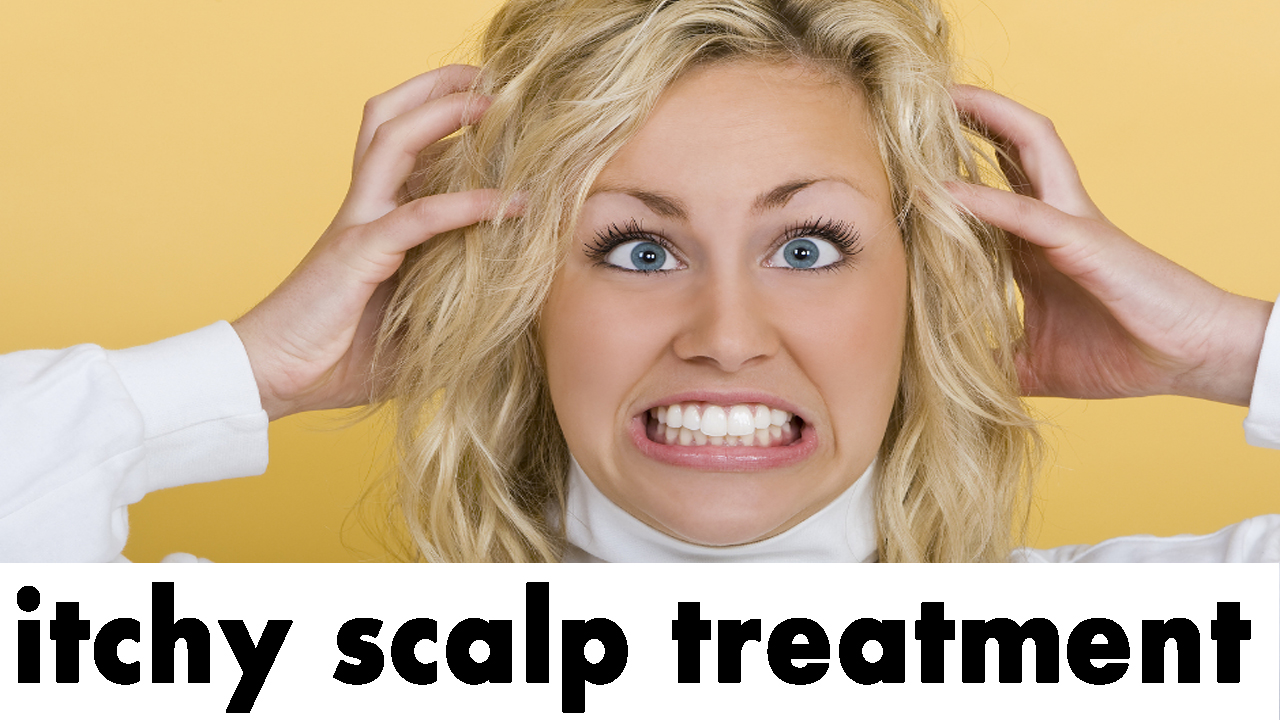 HOW TO GET RID OF DRY ITCHY SCALP With NATURAL Home Remedies