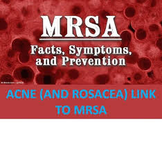 Acne and Rosacea Link to MRSA