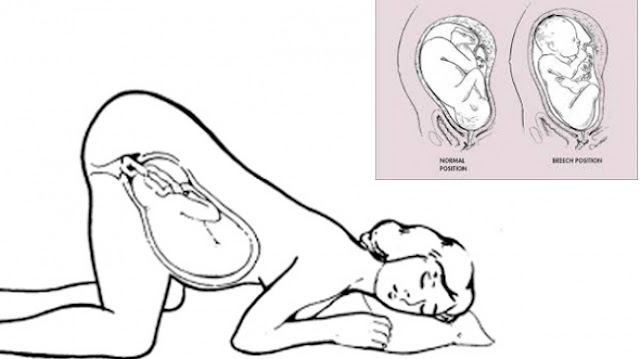 posisi sujud ibu hamil