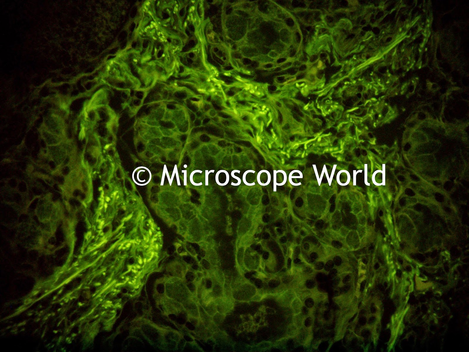 esophagus as seen with fluorescence microscopy 400x