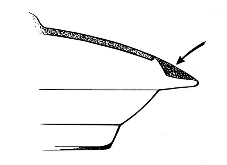 Tick Bitting Diagram