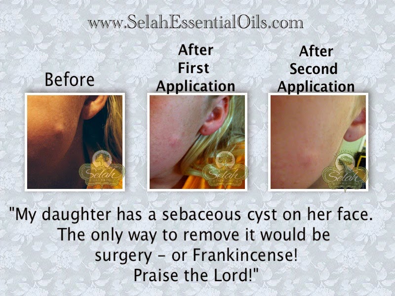 Selah S Oily Blessings Cyst And Frankincense Essential Oil
