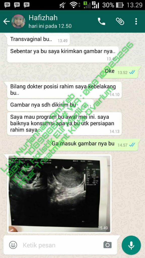 Biaya Usg Di Rumah Sakit Bella Bekasi 2019 Sekitar Rumah